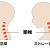 ストレートネックについて