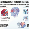群発頭痛の診断と治療【2025年最新版】