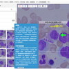 人工知能ベースのオンラインプラットフォームが血球形態学学習を支援する： 混合方法による逐次説明型設計研究