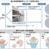 卵アレルギー、早くから食べると発症率低下