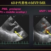 ECG-231 : Answer