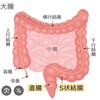 S状結腸