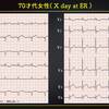 ECG-271：answer(2/2)