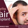 Hair Transplant Surgery in Delhi - Take the Right Step to Overcome Hair Loss