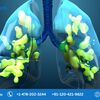 Acute Respiratory Distress Syndrome Market, Global Forecast, Industry Trends, Growth