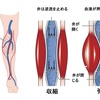 ふくらはぎ むくみ 原因 病気
