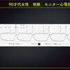 ECG-313：answer 