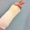 左手が役立たずになる