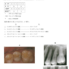 117回歯科医師国家試験【117C-51】保存修復学：歯質に対応した修復処置