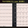 ECG285：70才代男性。汗びっしょりで転倒してERへ。