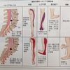 腰椎椎間板ヘルニア症