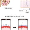 糖尿病性腎症の新しい発症メカニズムを発見