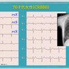 ECG-361：answer  その3 = 心電図検定試験：傾向と対策 Q.009 =