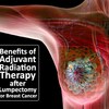 Benefits of Adjuvant Radiation Therapy after Lumpectomy for Breast Cancer