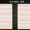 ECG-363：answer その2 　問題の解答編= 心電図検定試験：傾向と対策 Q.011 =