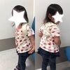 子供2歳7ヶ月鎖骨が折れてました。2日目の診察記録