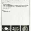 4月24日＊MRI検査結果