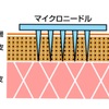 企業研究①～注射がなくなる未来へ～