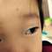 【白目の中の黒いシミ】子供の目の病気！？病院行ったほうがいいの？