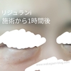 【リジュランi】ダウンタイム・腫れが何日続くか画像で経過まとめ【体験談】