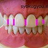 （4）歯の「三面磨き」の方法。　歯ブラシの毛先（断面）で、歯垢が落ちる磨き方。