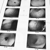 初めて胃カメラ検査を受けました