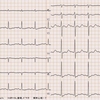 ECG-181：answer