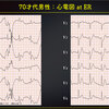 ECG-334：70才代男性。shockです。