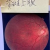 美容男子のシワ対策21 老化対策！？