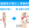 腰痛と大腿四頭筋の関係。