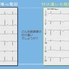 【コラム-140】：ECG Yellow web Book-006-肢誘導の付け違い問題- T-S method-その4】📕→📘→📙