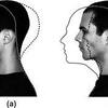 クラシックと非クラシックの有名男性歌手における高音発声時の頭のポジションの違いの観察研究 