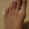 足ゆび強打(ToT)