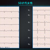 ECG-361：4枚の心電図に共通する心電図所見は？ = 心電図検定試験：傾向と対策 Q.009 =