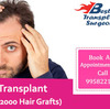 Hair Transplant Surgery in Delhi – The Best Treatment to Overcome Hair Loss and Baldness