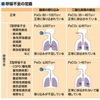 【看護学生さん必見】呼吸不全とNPPVの観察点