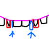 30から始めるオトナの前歯のみ矯正　～スキマが気になる～