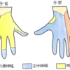 橈骨神経麻痺への対応