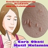 Obat Perontok Kutil Kelamin De Nature Indonesia