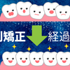 【歯列矯正ブログ】いよいよ最後のホワイトワイヤー！【今月の調整の記録】