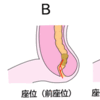 💩『うんこを楽に出す』には実はちょっとしたコツがある💩💩