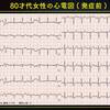 ECG-210：answer(その１)