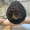 11ヵ月+20日目　11month & 20days