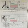 骨の薬を飲み始めて1年、骨密度測定と、坐骨神経痛（に決定？）