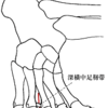 足の裏の痛みの原因となる「モートン病」について整形外科医が解説してみました 