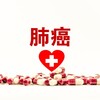 様々な新しい治療法との組み合わせにより、肺がんの5年生存率は50%を超えることもあり、肺がんは慢性疾患となりつつあります。