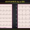 ECG-265：answer