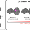 アルツハイマー病の hippocampal sparing subtype を神経病理および in vivo tau PET で評価する: システマティックレビュー