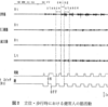 すくみ足・小刻み歩行を呈するパーキンソン病に対する歩行訓練