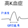 高K血症への対応　これだけ